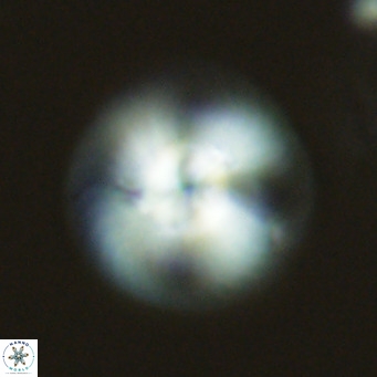Calcidiscus leptoporus VR 03674