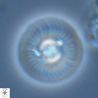 Calcidiscus leptoporus VR 03670