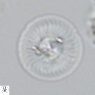 Calcidiscus leptoporus VR 03671