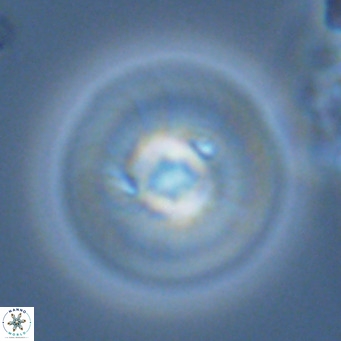 Calcidiscus leptoporus VR 03673