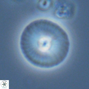 Calcidiscus leptoporus VR 03854