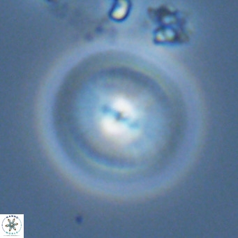 Calcidiscus leptoporus VR 03855
