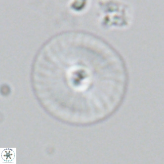 Calcidiscus leptoporus VR 03851