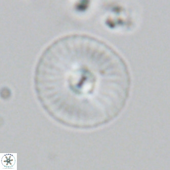 Calcidiscus leptoporus VR 03852