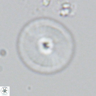 Calcidiscus leptoporus VR 03853