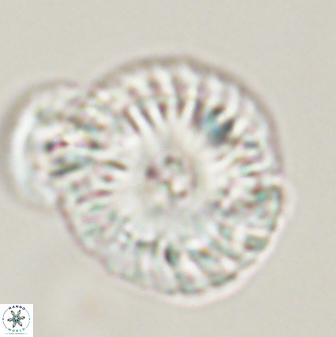 Calcidiscus pacificanus 55503