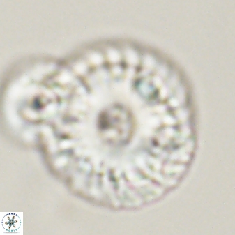 Calcidiscus pacificanus 55504