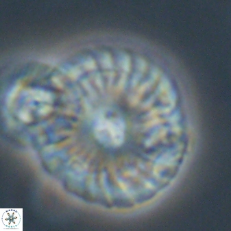 Calcidiscus pacificanus 55505