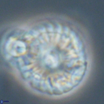 Calcidiscus pacificanus 55509