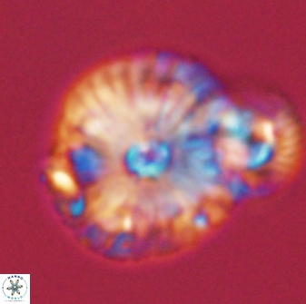 Calcidiscus pacificanus 55519