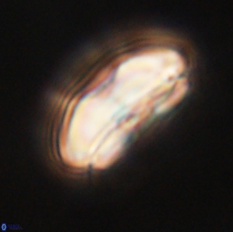 Calcidiscus pacificanus 60461