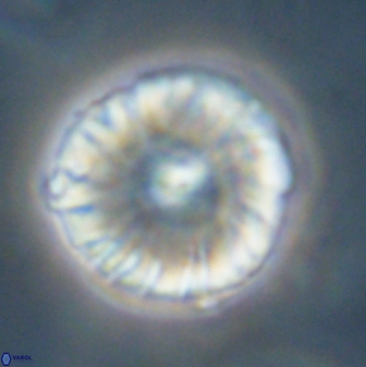 Calcidiscus pacificanus 60468