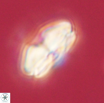 Calcidiscus pacificanus 60473