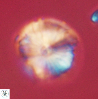 Calcidiscus pacificanus 60485