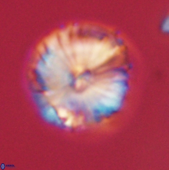 Calcidiscus pacificanus 60487