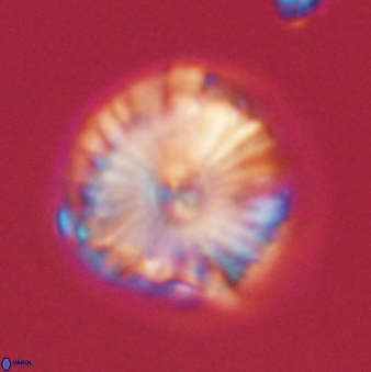 Calcidiscus pacificanus 60488