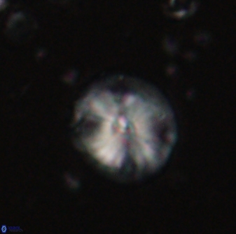 Calcidiscus pacificanus 60750