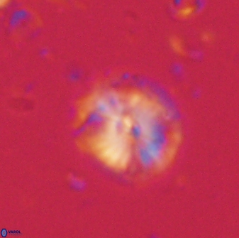 Calcidiscus pacificanus 60751