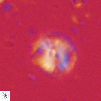 Calcidiscus pacificanus 60751