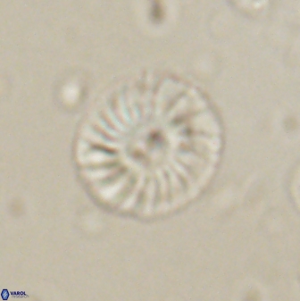 Calcidiscus pacificanus 60754