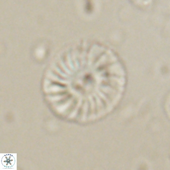 Calcidiscus pacificanus 60754