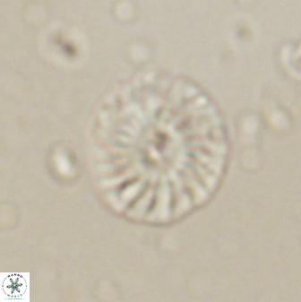 Calcidiscus pacificanus 60755