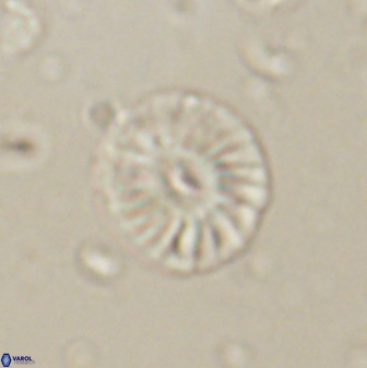Calcidiscus pacificanus 60756