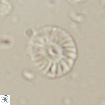 Calcidiscus pacificanus 60756