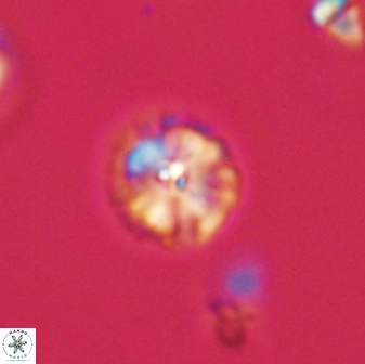 Calcidiscus pacificanus 63712
