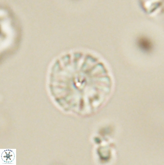 Calcidiscus pacificanus 63714
