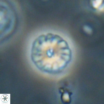 Calcidiscus pacificanus 63716