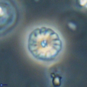 Calcidiscus pacificanus 63717