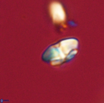 Calcidiscus pacificanus 63719