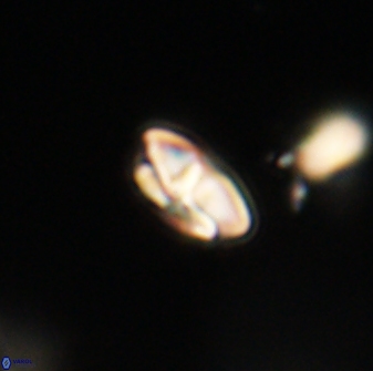 Calcidiscus pacificanus 63721