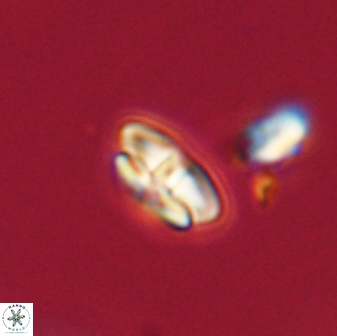 Calcidiscus pacificanus 63723
