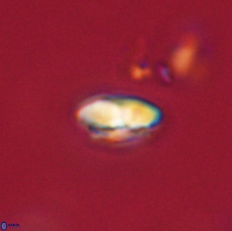 Calcidiscus pacificanus 63724