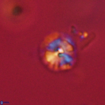 Calcidiscus pacificanus 63728