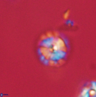 Calcidiscus pacificanus 63736