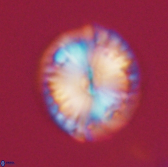 Calcidiscus pacificanus 21565