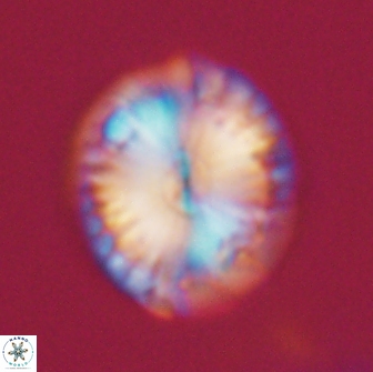 Calcidiscus pacificanus 21566