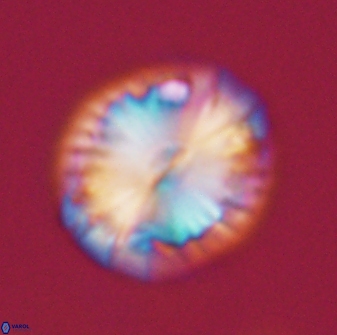 Calcidiscus pacificanus 21570