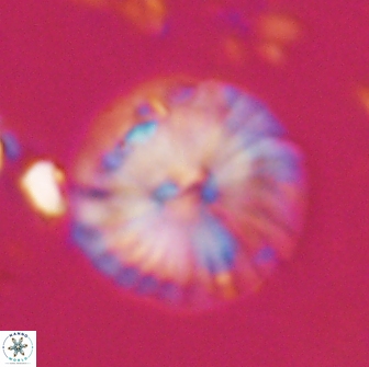 Calcidiscus pacificanus 22215