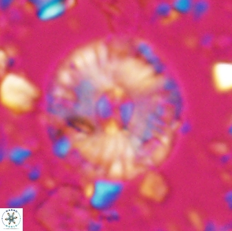 Calcidiscus pacificanus 22504
