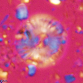 Calcidiscus pacificanus 22507