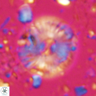 Calcidiscus pacificanus 22507