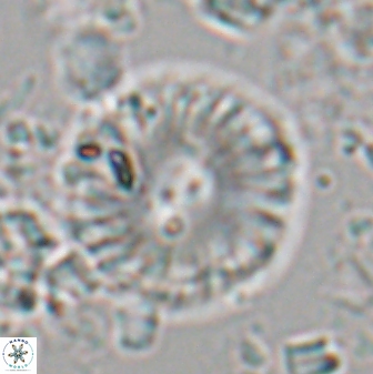 Calcidiscus pacificanus 22508