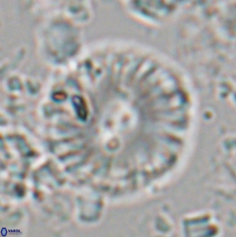 Calcidiscus pacificanus 22509