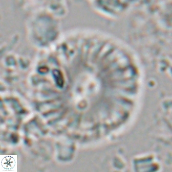 Calcidiscus pacificanus 22509