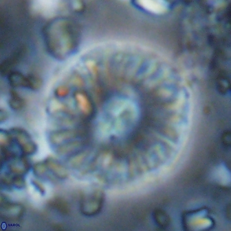 Calcidiscus pacificanus 22510