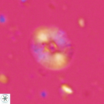 Calcidiscus parvicrucis 29029